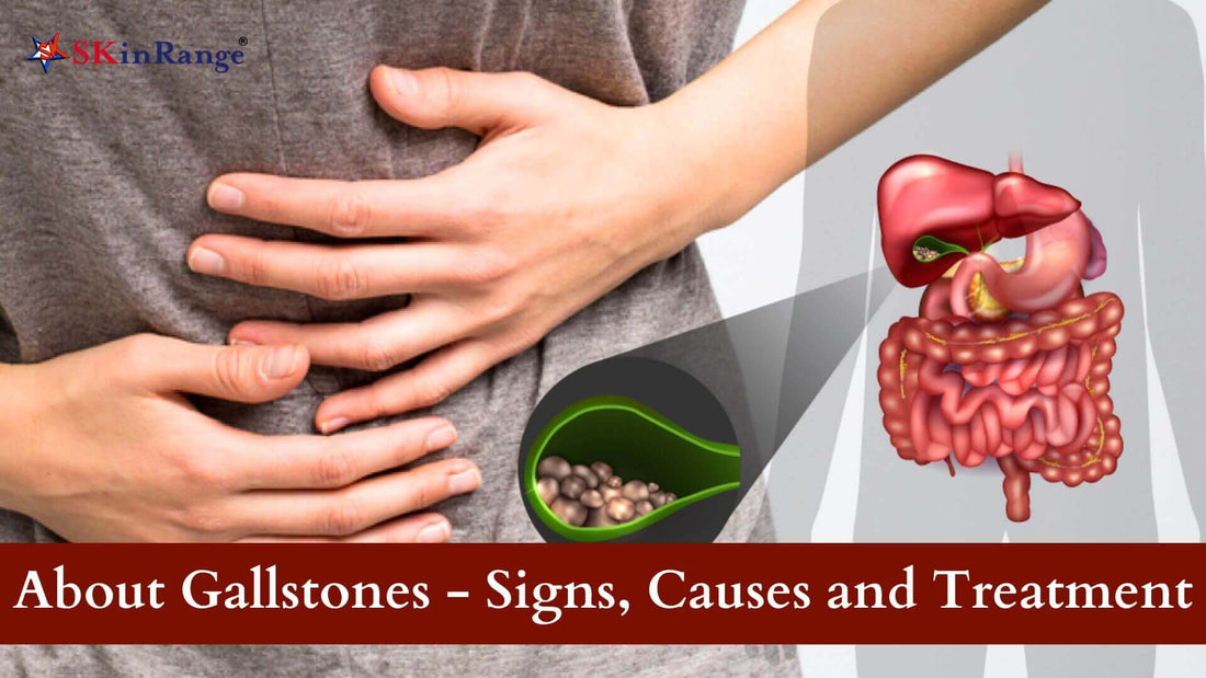 Gallstones - Signs, Causes, and Treatment - SKinrange