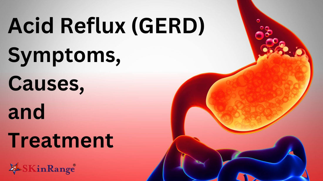 Acid Reflux (GERD) : Symptoms, Causes, and Treatment