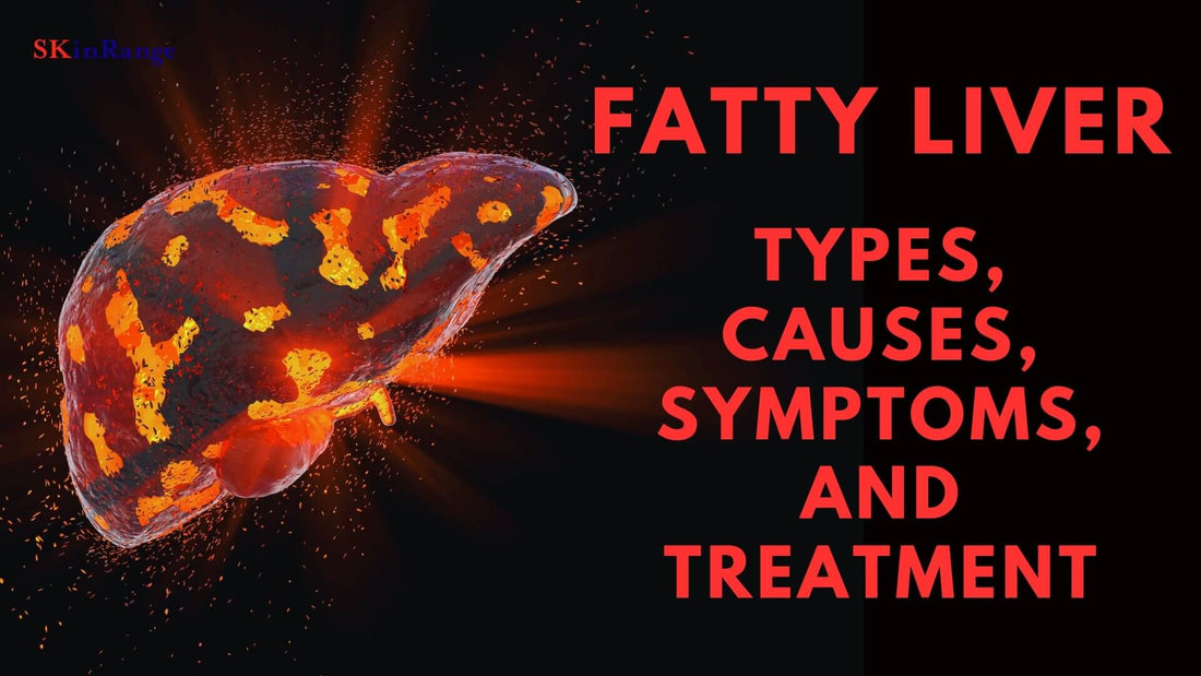 Fatty Liver - Types, Causes, Symptoms, And Treatment