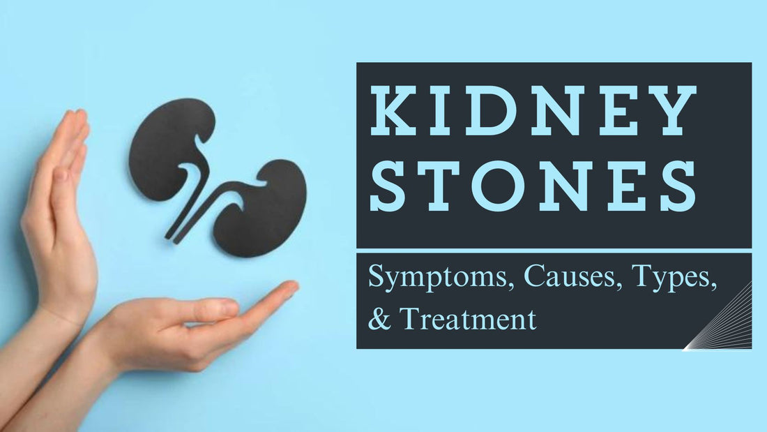 Kidney Stones - Symptoms, Causes, Types, and Treatment
